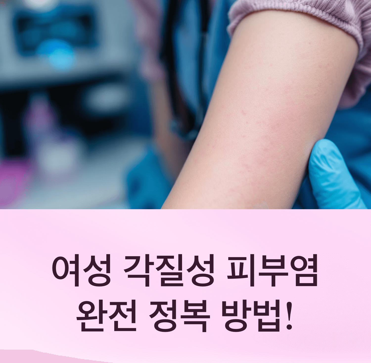 닭살(모공각화증)이 있는 한국인 여성의 팔 클로즈업, 부드러운 조명, 임상 사진 스타일