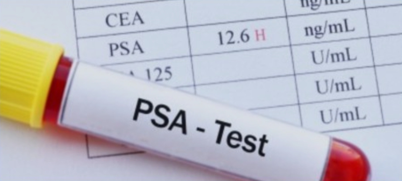 전립선암 수술 후 psa수치