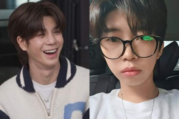 정동원 성형 논란