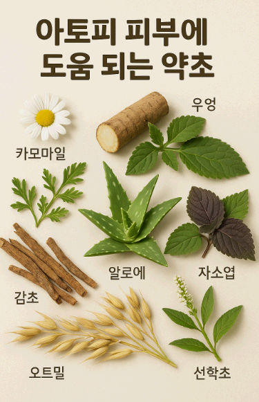 아토피 피부에 도움이 되는 약초