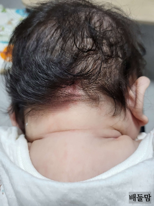 뒷통수 연어반 사진1.