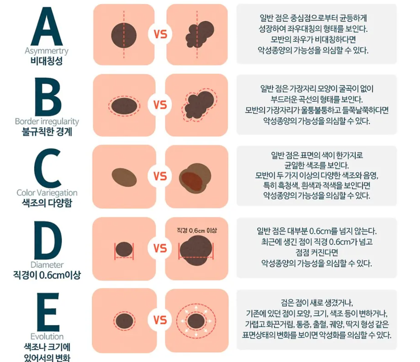 악성여부확인법