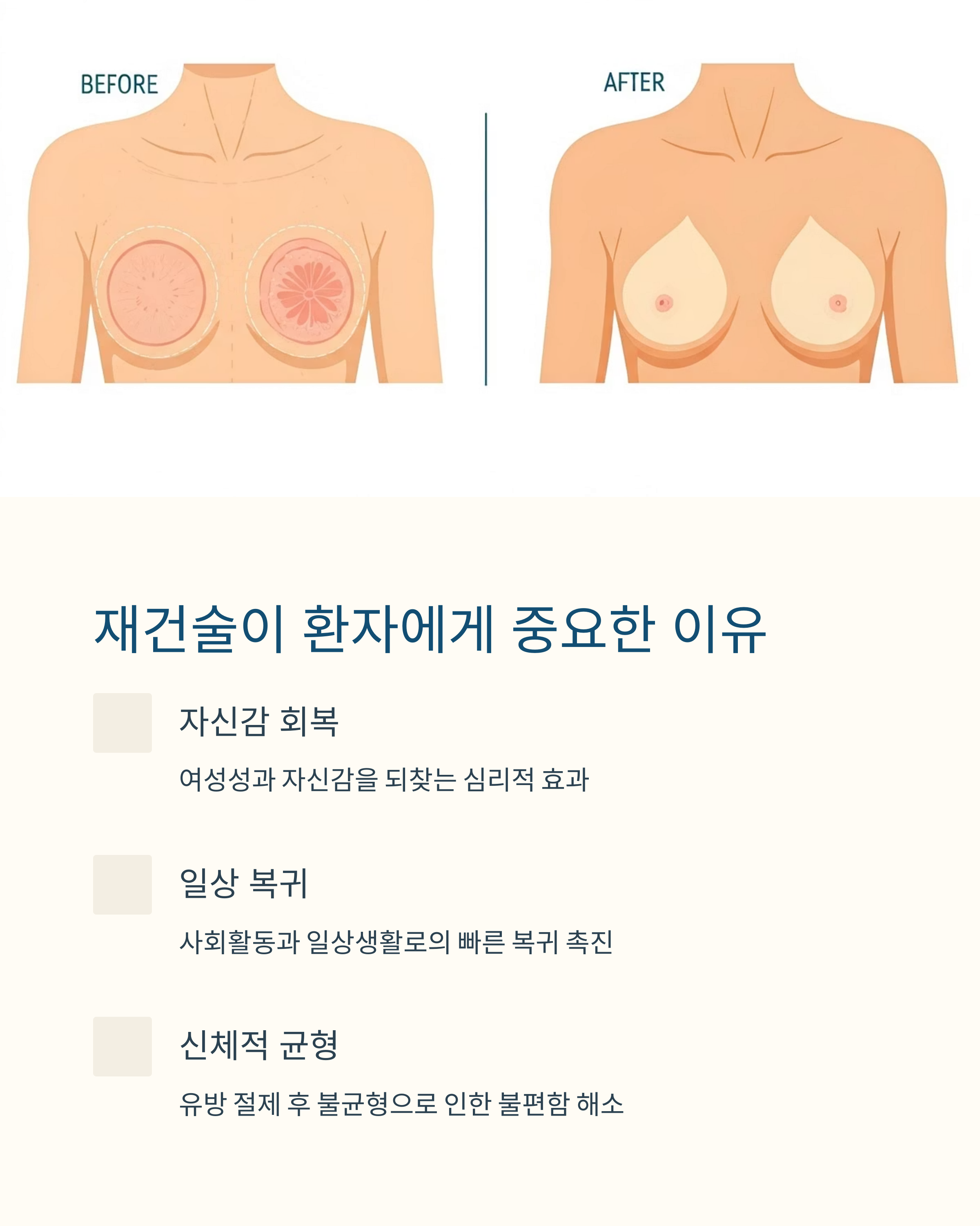 유방재건술이 환자에게 중요한 이유