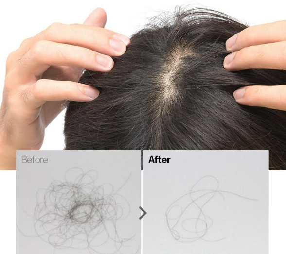 그래비티 탈모예방 샴푸 총정리 (후기&amp;#44;종류&amp;#44;비교)