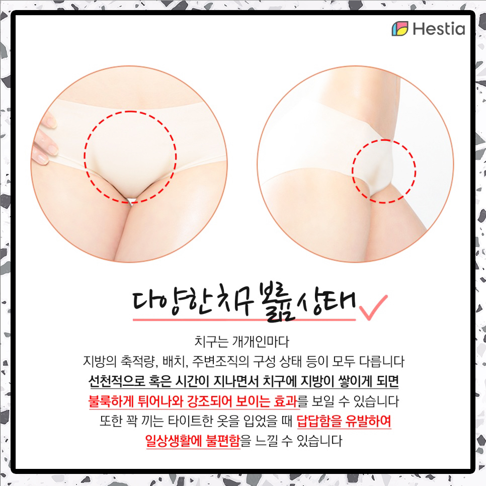 다양한 치구 볼륨 상태