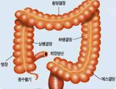 대장암의 특징과 증가 추세