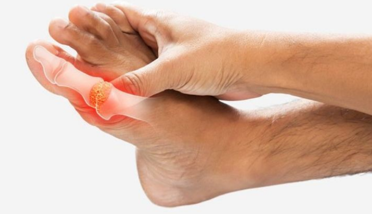 엄지-발가락-관절이-아픈-사진