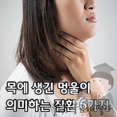 턱 밑 멍울