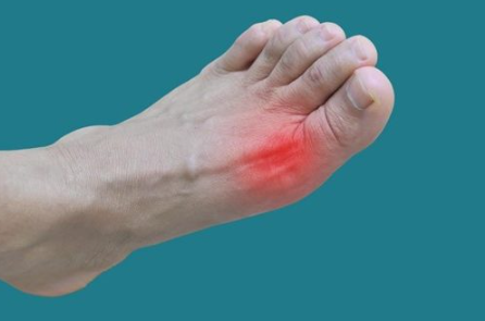 엄지 발가락 옆 통증