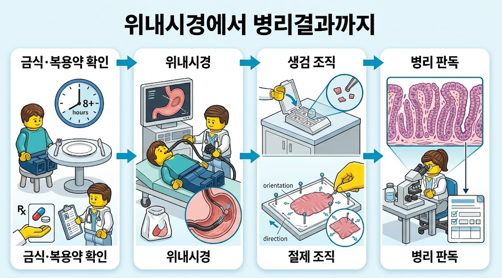 위내시경 검사부터 생검 조직 채취와 병리 판독까지 이어지는 위 조직검사 과정 안내 이미지