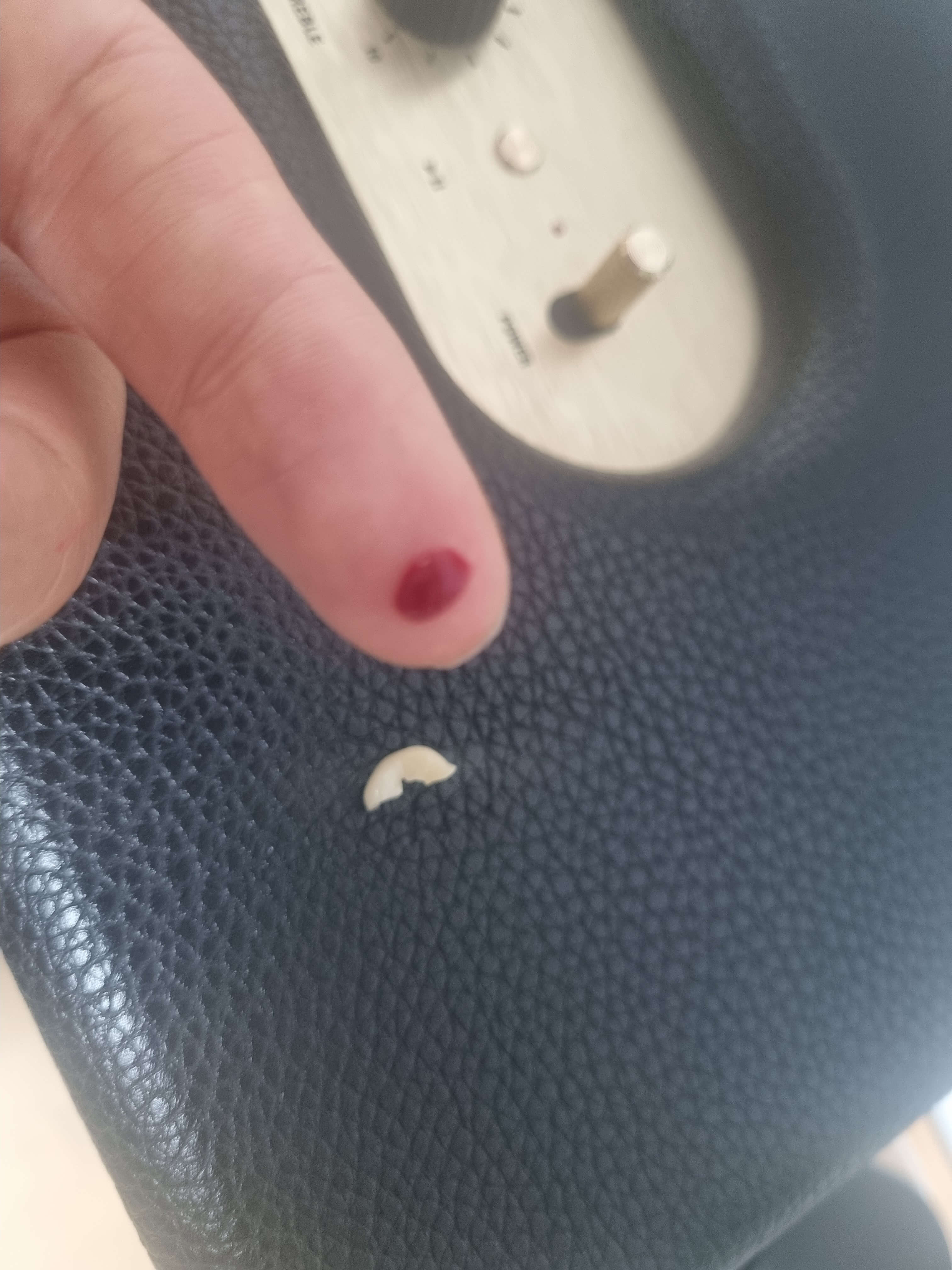 임플란트 깨짐 날카로움