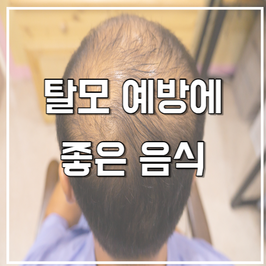 탈모 예방에 좋은 음식