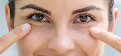 다크서클의 원인과 해결책