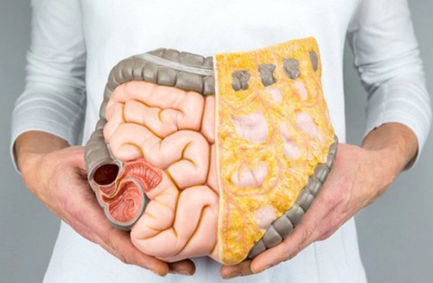 내장지방 빼는법 운동 음식 및 내장지방 레벨 수치 총정리