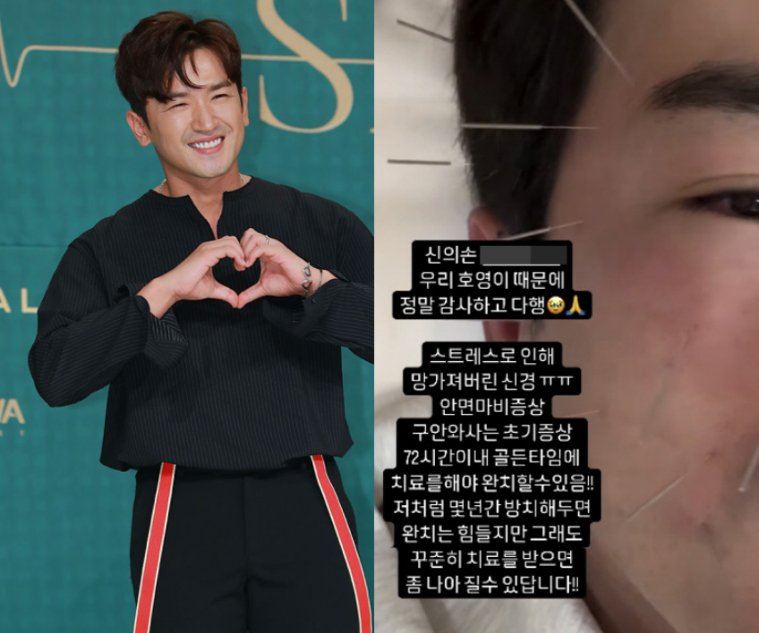 이민우 안면마비 치료 사진