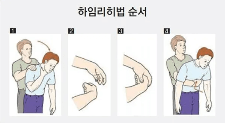 성인 하임리히법 일러스트 설명 4단계