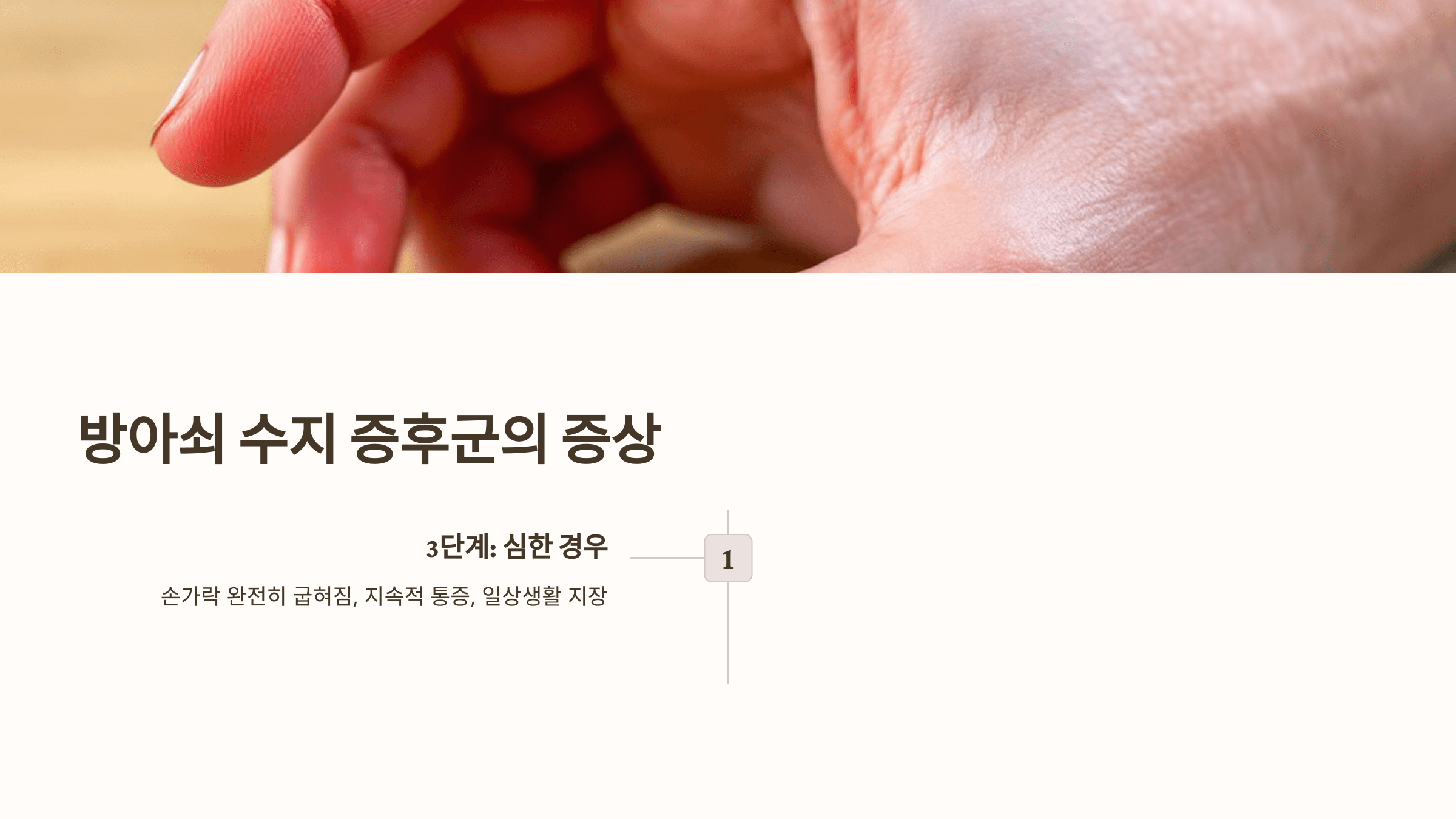 방아쇠 수지 증후군 관련된 사진입니다.