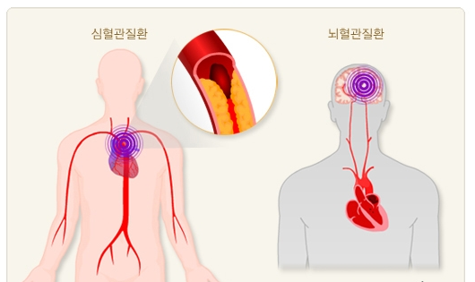 대사증후군