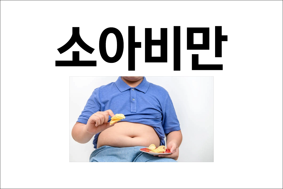 소아비만 원인 예방 해결방안