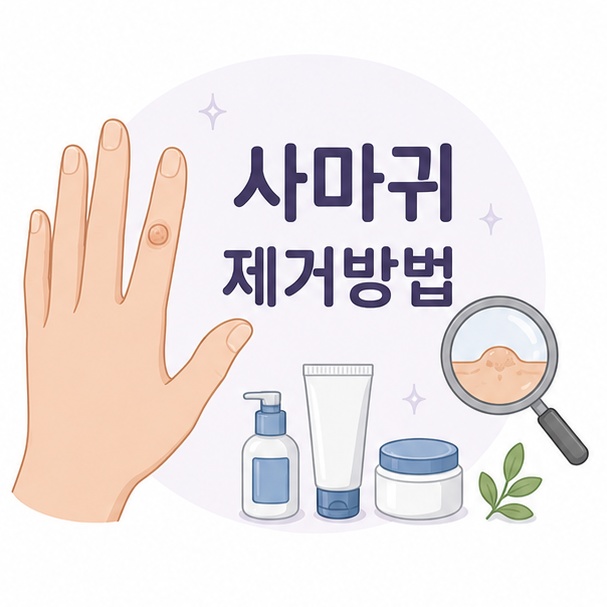 손가락에 생긴 일반적인 사마귀를 이용해 안전한 사마귀 제거방법을 소개하는 그림