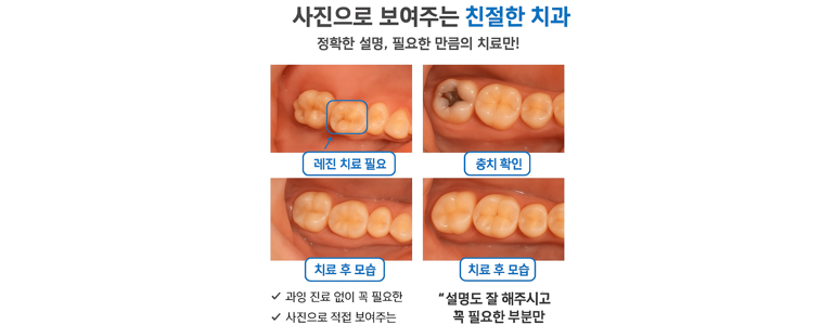 안산 상록구 틀니 병원