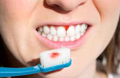 이빨에서 피나는 장면