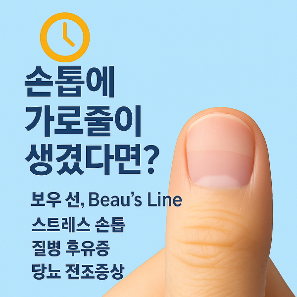 손톱에 가로줄이 생겼다면?/gpt