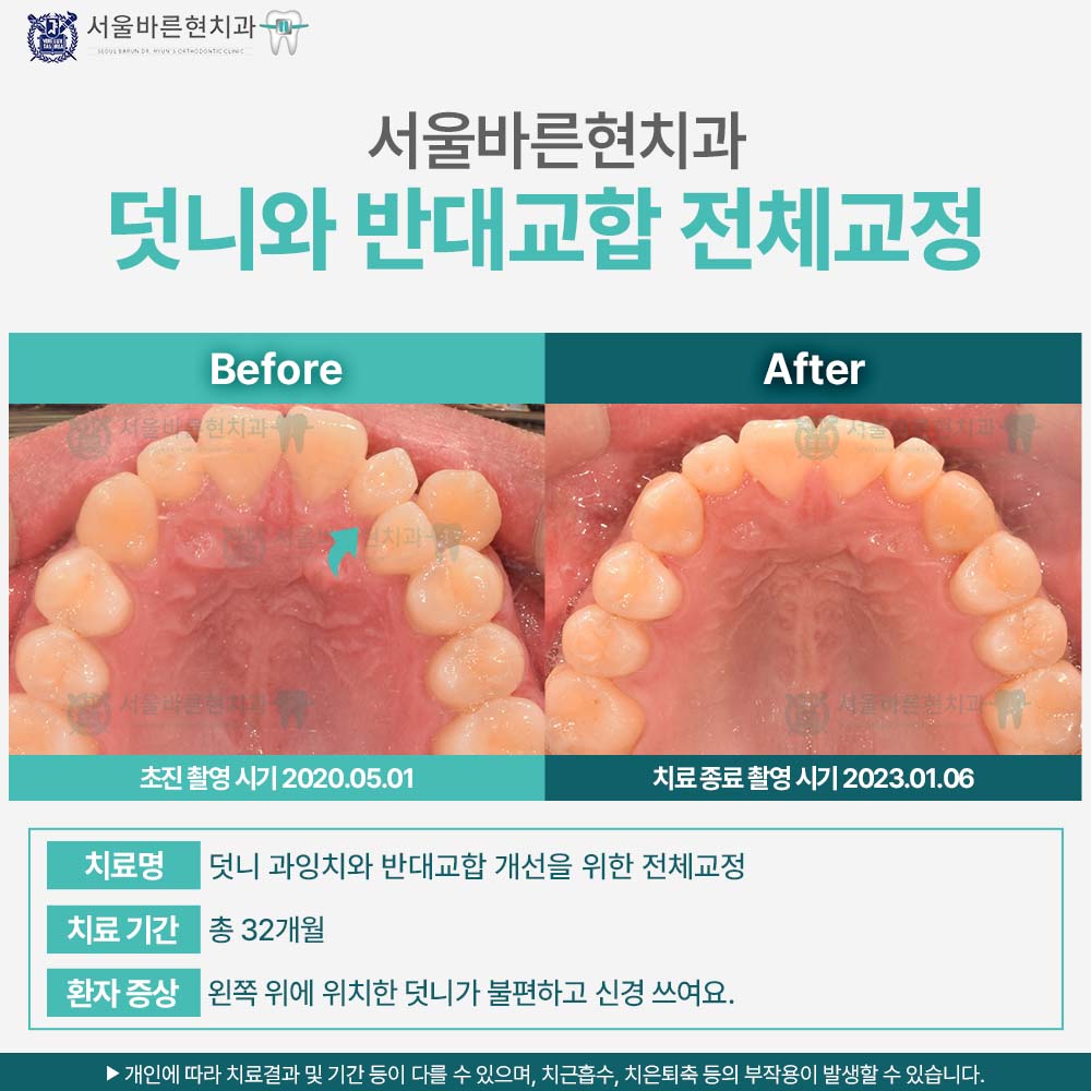 해운대교정치과