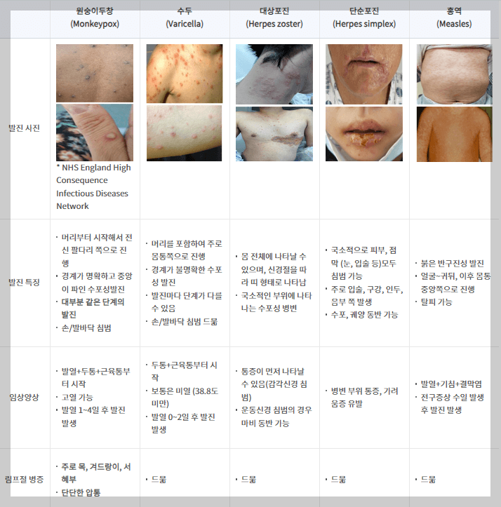 엠폭스와 다른 질병을 구분하는 방법을 보여주는 증상 설명 표