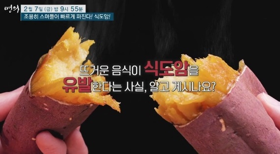 EBS명의-식도암-박종재-교수