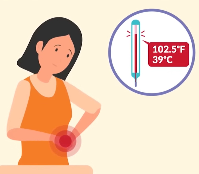 급성 신우신염 증상