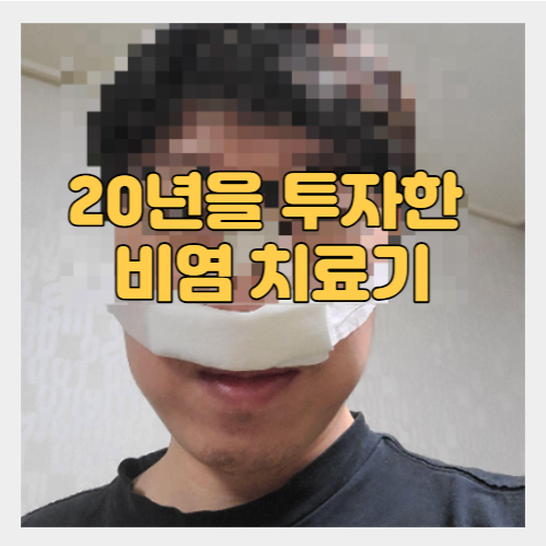 20년 비염 치료기