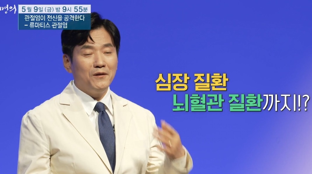 EBS명의-류마티스-관절염-주지현교수