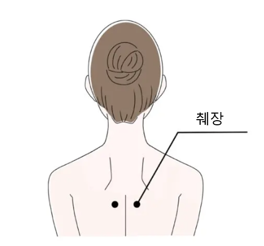 췌장