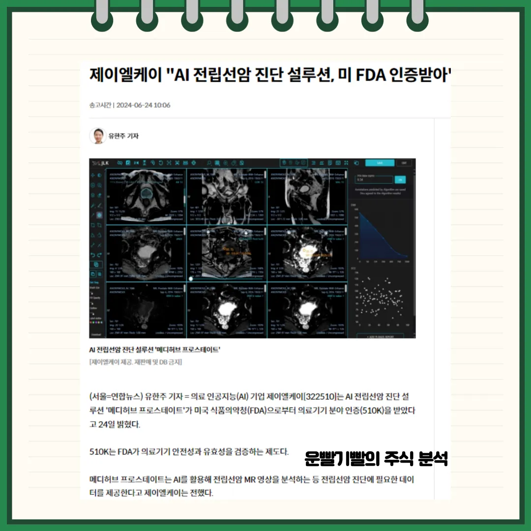 제이엘케이 뉴스
