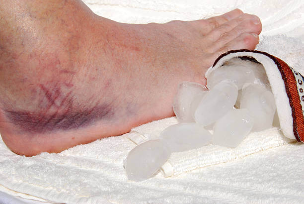 멍 빨리 빼는 법&amp;#44; 멍 드는 과정과 색깔. 멍을 빨리 빼는 방법은 염증을 완화시키고 치유 과정을 가속화하는 다양한 방법들을 포함하고 있습니다. 멍이 생기면 지금 당장 대응하는 것이 중요하며&amp;#44; 올바른 방법을 통해 치료하면 멍의 기간을 단축시킬 수 있습니다.