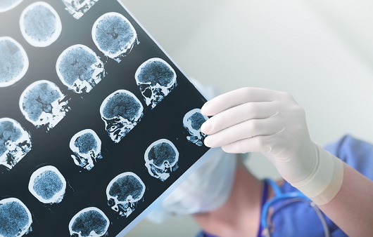 brain x-rays and doctors