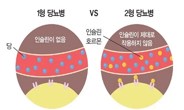 출처 당봄한의원