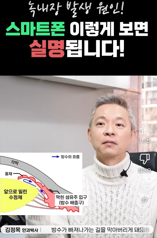 녹내장-명의-박찬기-교수-안과