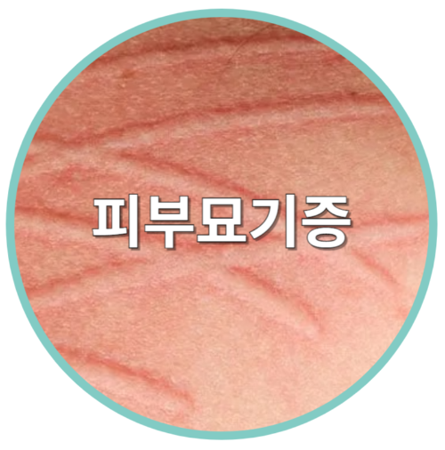 피부묘기증