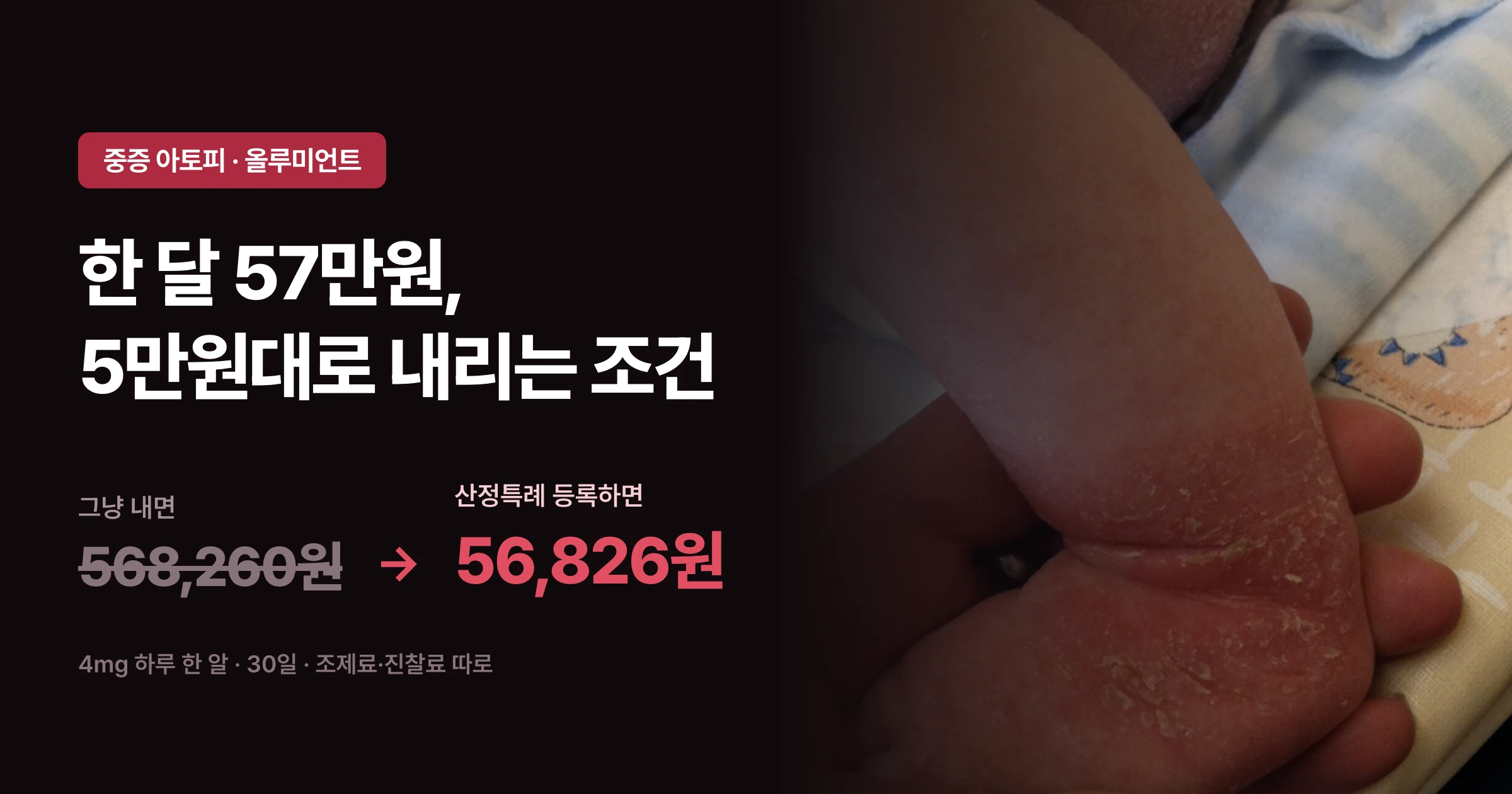 올루미언트 한 달 약값 568,260원이 산정특례 등록으로 56,826원이 된다는 요약 이미지