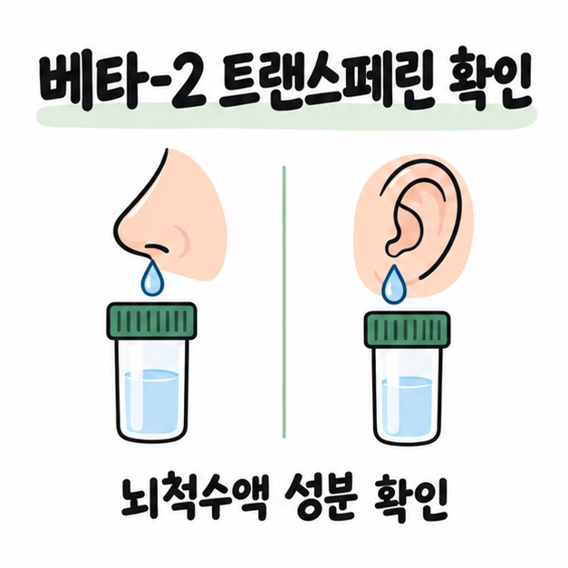 코와 귀에서 나온 맑은 액체를 검사 용기에 담아 베타-2 트랜스페린을 확인하는 모습을 보여주는 카드