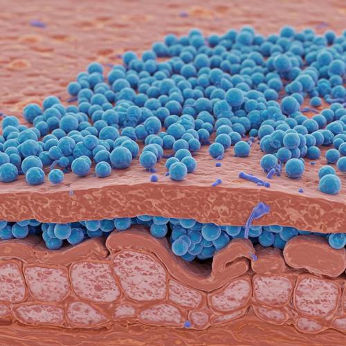 콘드로이친 부작용