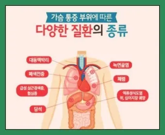 명치끝이 아픈이유 종류별 낫는법까지 완벽 해결_6