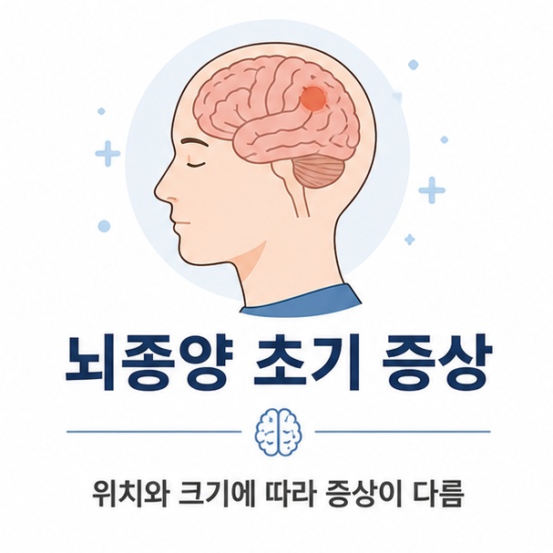 사람의 뇌를 단순하게 표현하고 뇌종양 초기 증상은 종양의 위치와 크기, 성장 속도에 따라 서로 다르게 나타날 수 있음을 보여 주는 그림