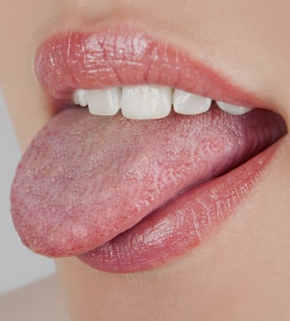 설태제거해야하는이유