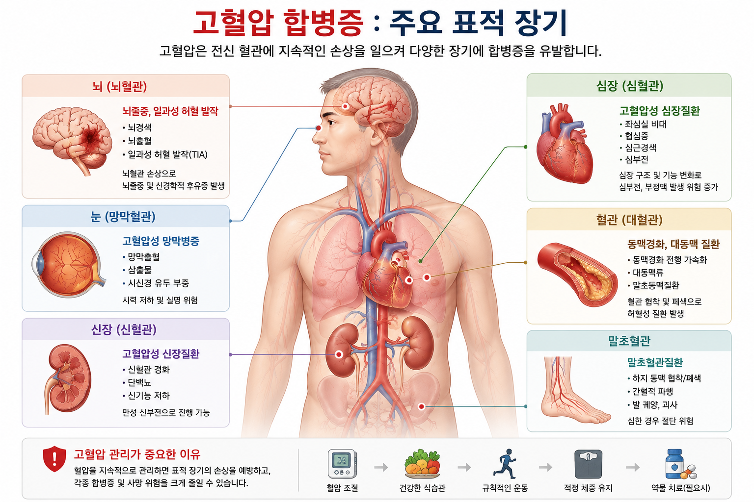 고혈압이 위험한 이유 7가지