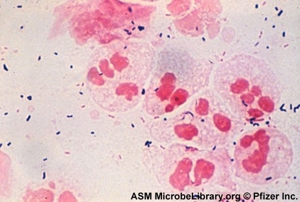 비임균성 요도염