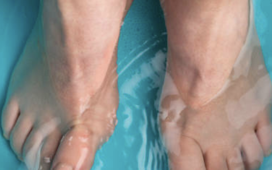 티눈 없애는 방법