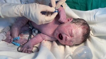 간호사가-갓-출산해-힘차게-울고있는-사내아이-손목에-태그를-붙여주는-모습